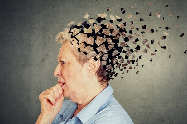 Alzheimer’ı 20 Yıl Önce Öngören Test Geliştirildi