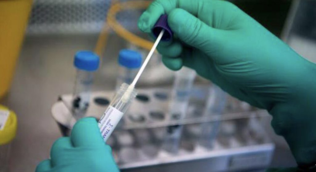Finlandiya’da PCR testlerinde görülmeme ihtimali olan yeni bir mutasyon keşfedildi