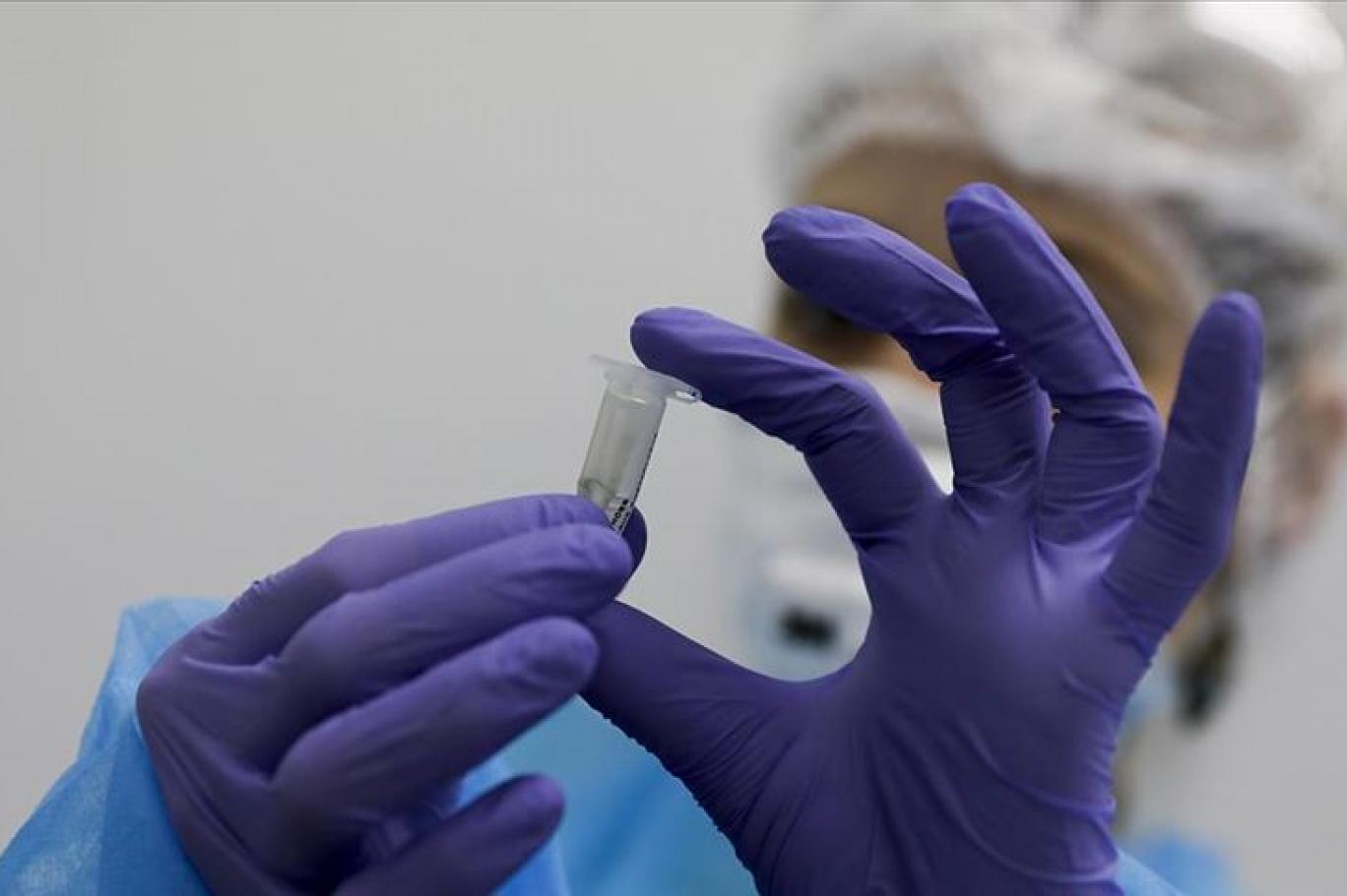 antijen test