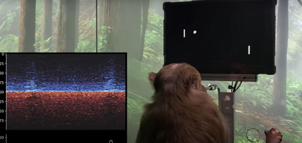 Elon Musk’ın ‘beyin çipi’ projesi bir maymun üzerinde test edildi