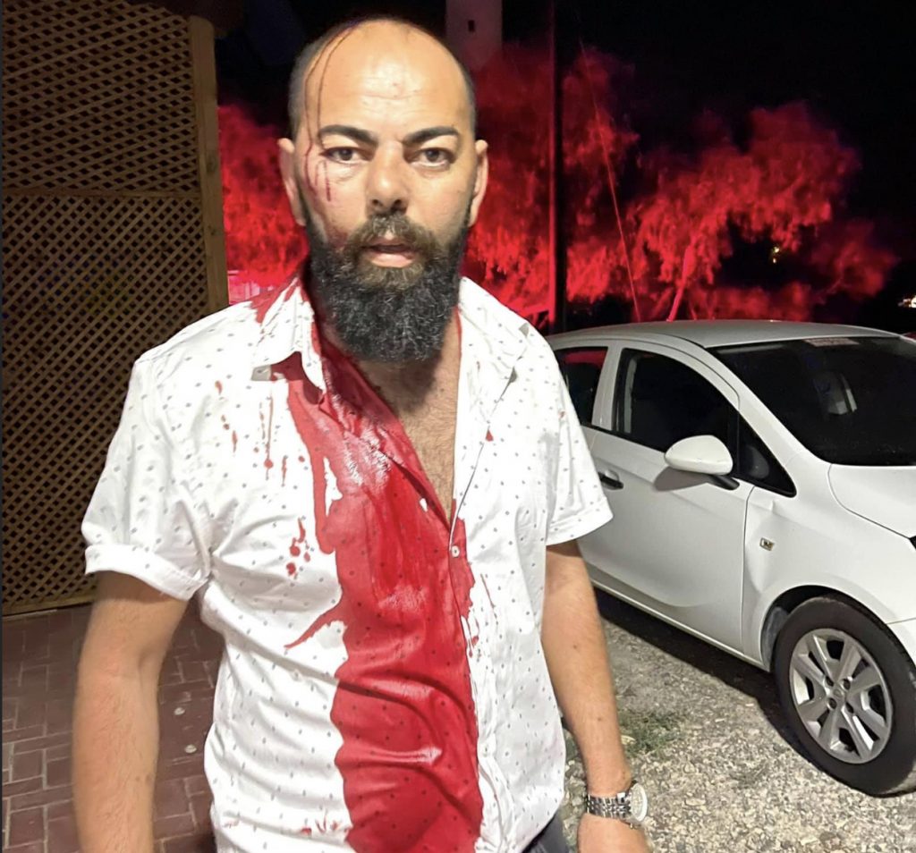 Çağlar Yüksel: ‘Bana yapılan bu saldırıyı yerde bırakmayacağız’