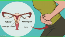 Her yıl 500 bin kadın bu hastalıkla tanışıyor!