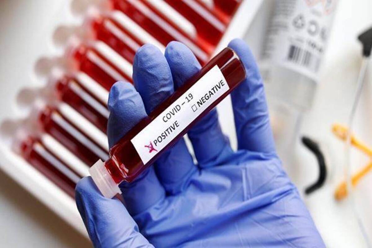 Güney Kıbrıs’ta 2 bin 815 yeni vaka 1 can kaybı!