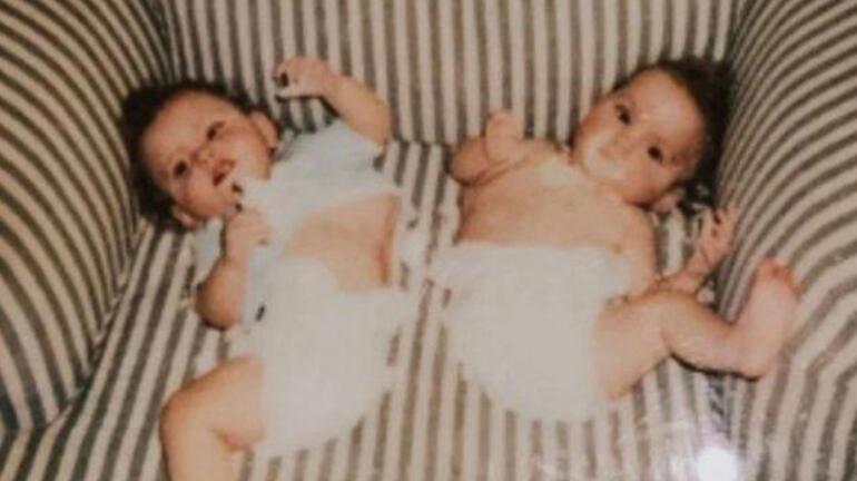 Yapışık ikizinin hayalini gerçekleştirdi! TikTok’u sallıyor