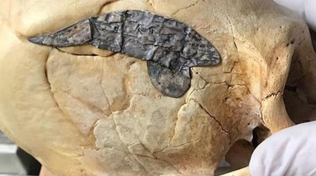 Topraktan Çıkarılamayan Kafatası Müzede Korumaya Alındı