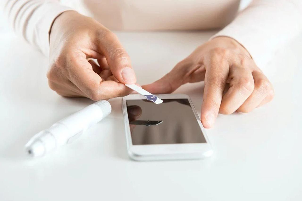 akıllı tel pcr