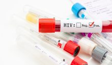 Bakanlıktan açıklama: HIV virüsü taşıyan kişiye çalışma izni verildi mi?